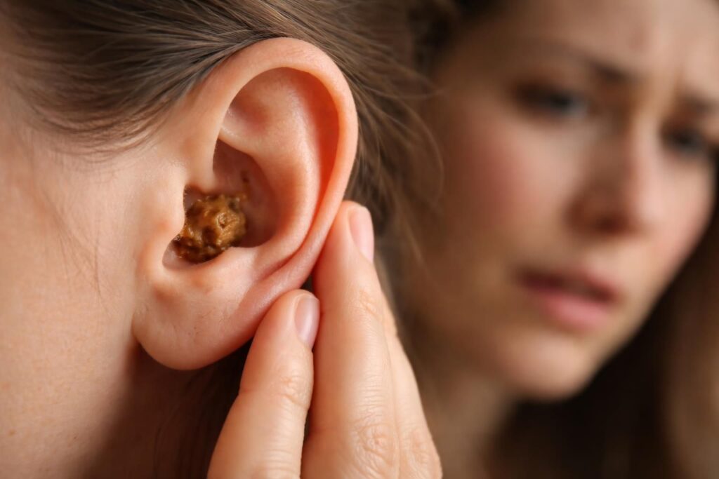 découvrez les symptômes inquiétants liés au bouchon d’oreille qui nécessitent une consultation rapide pour éviter les complications.